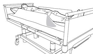 Fall prevention using wedges